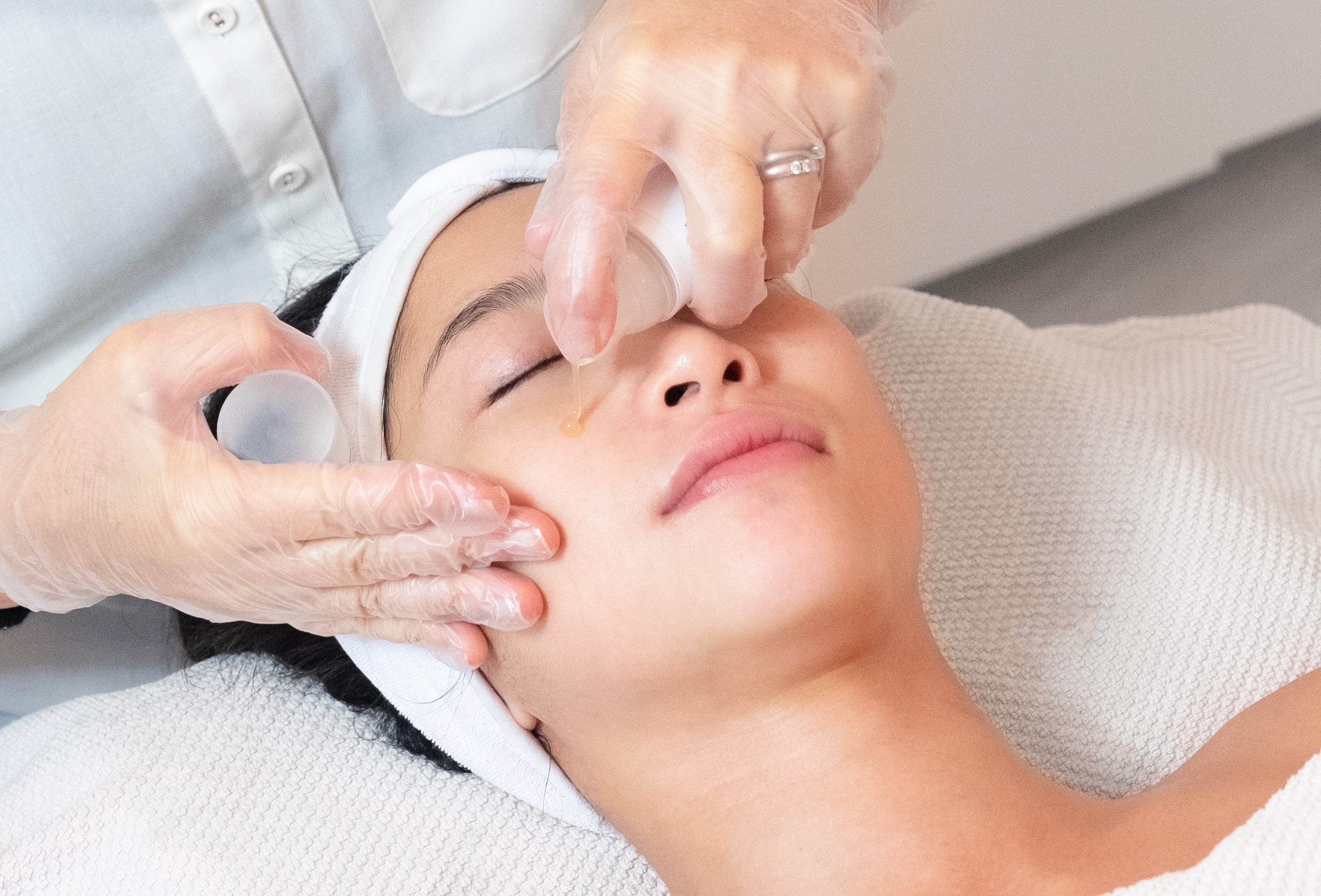 How to Improve Dark Circles Under the Eyes